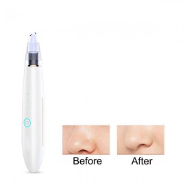 USO U60 Electric Blackhead Pore Cleaner